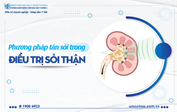 PHƯƠNG PHÁP TÁN SỎI TRONG ĐIỀU TRỊ SỎI THẬN